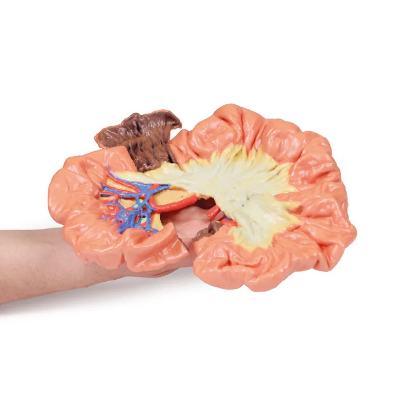 3D Printed Bowel - Portion of Ileum