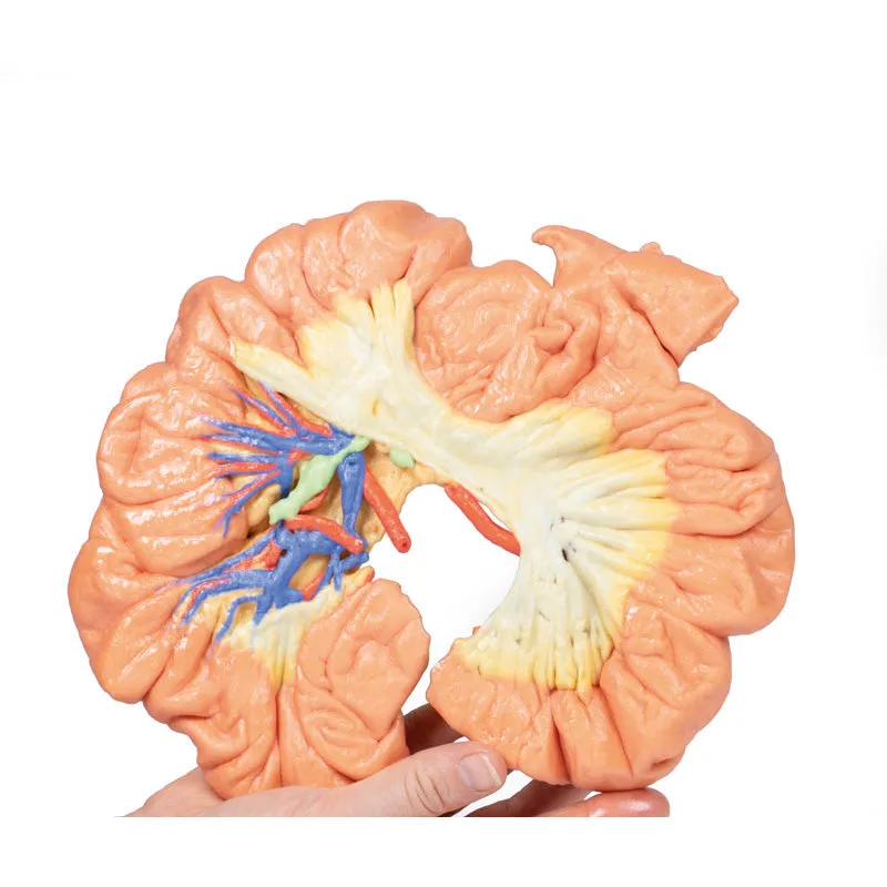 3D Printed Bowel - Portion of Ileum