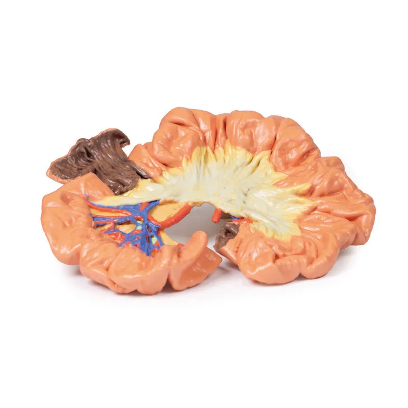 3D Printed Bowel - Portion of Ileum