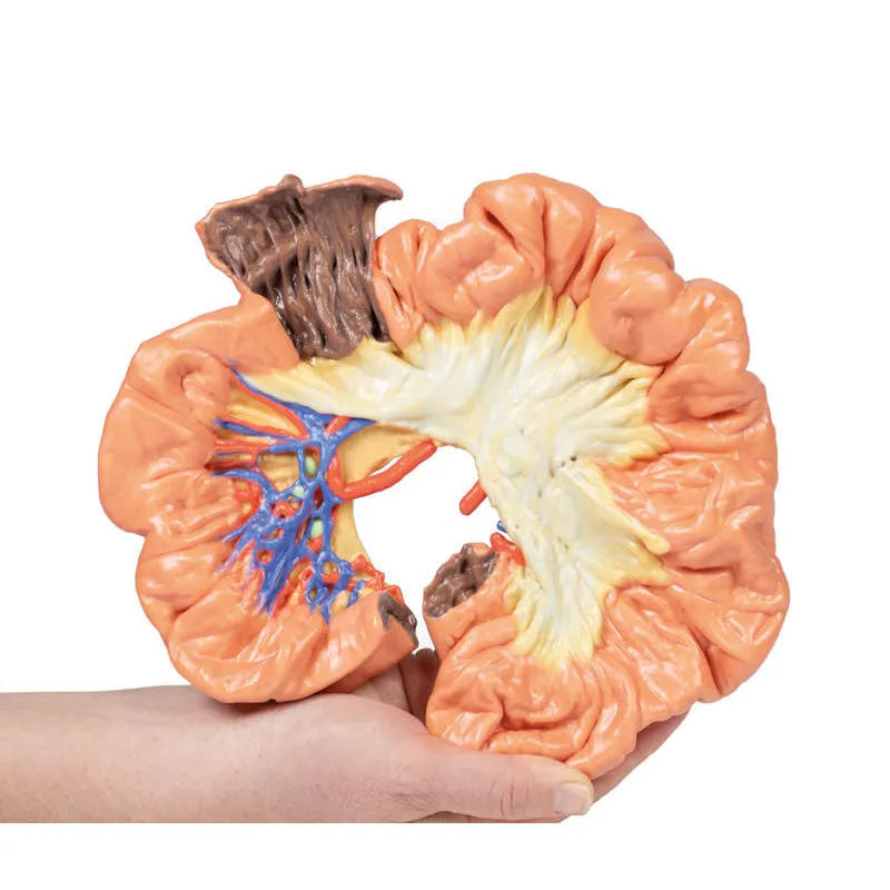 3D Printed Bowel - Portion of Ileum